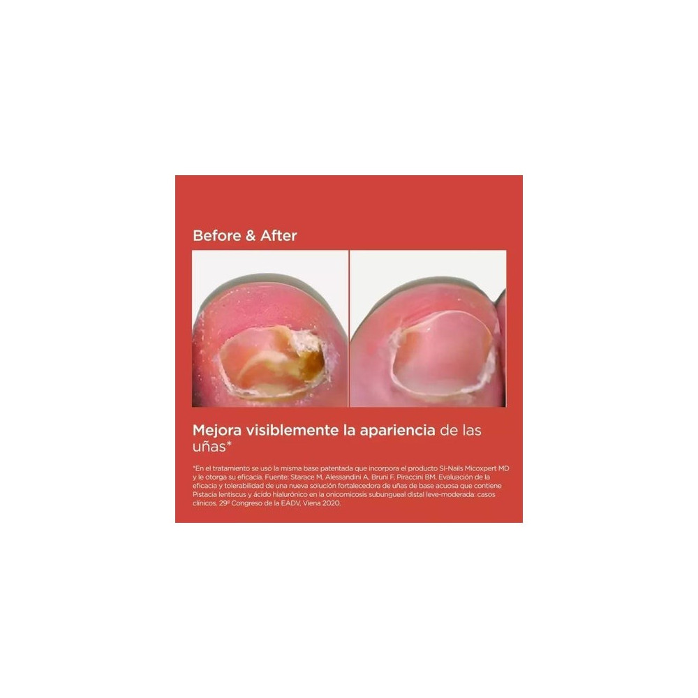 Isdin Si-Nails Micoxpert 4.5ml
