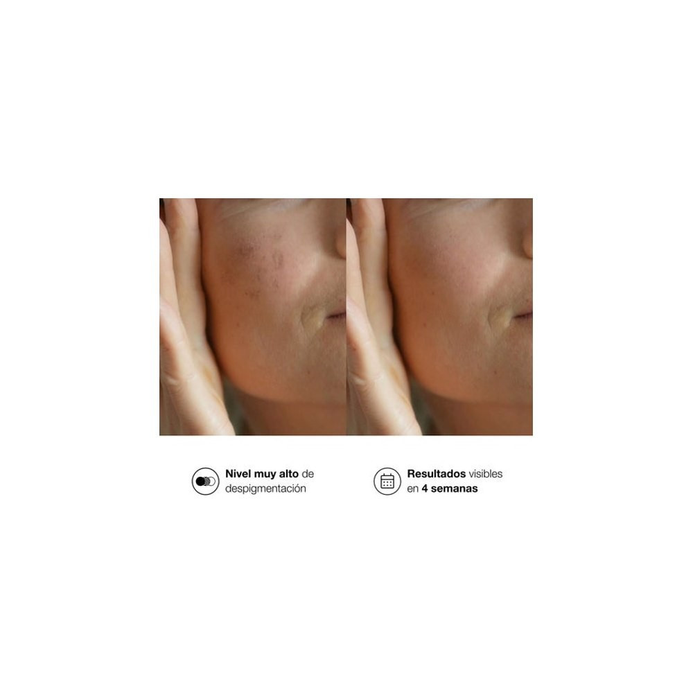 Bella Aurora Bio10 Forte M-Lasma Despigmentante 30ml